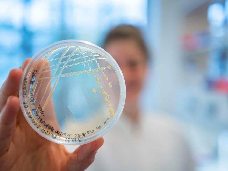 Forsker viser fram bakterieprøver på laboratoriet
